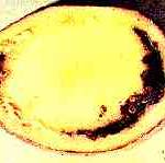 Clavibacter michiganensis ssp. sepedonicus Davis
