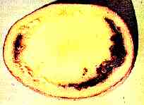 Clavibacter michiganensis ssp. sepedonicus Davis
